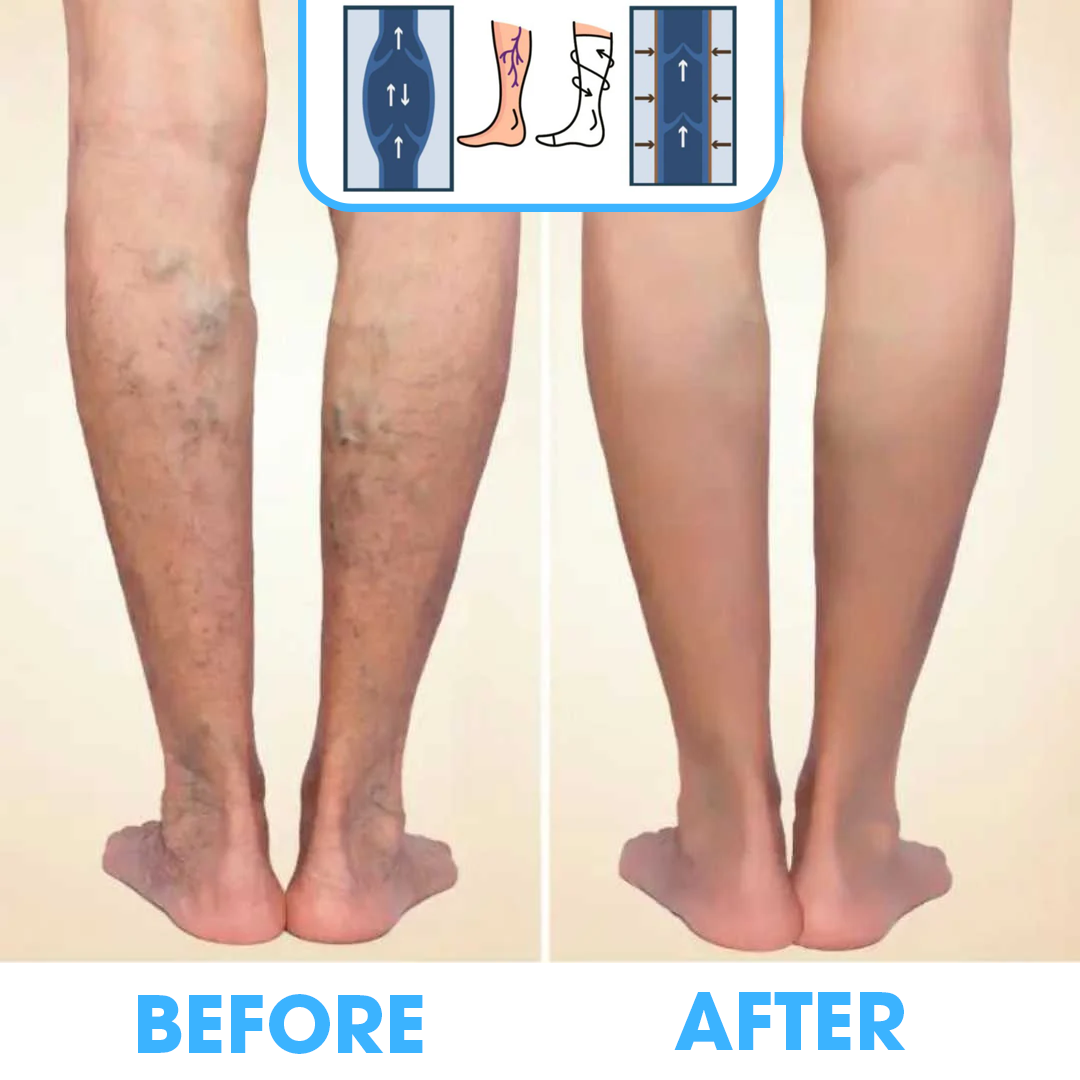FlowSocks™ - Compression Socks - FlowSocks™